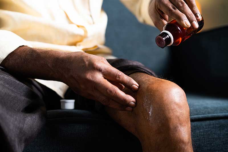 • Spliff Second best cannabis for arthritis pain