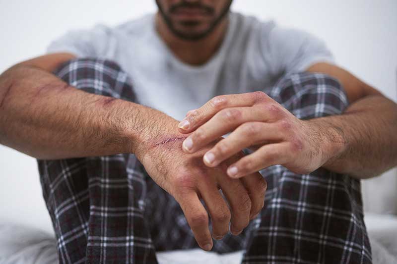 • Spliff Second cannabis strains for PTSD